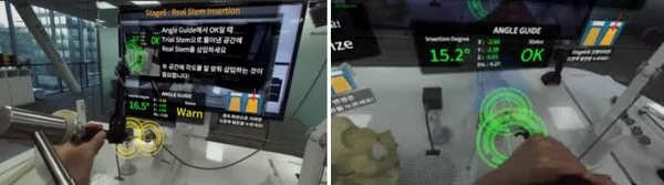 정형외과의 고관절 치환술 훈련 시뮬레이터